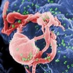 Aggressive HIV strain emerges in Caribbean region Aggressive HIV strain emerges in Caribbean region