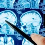 Consultants back CIG funded mental health facility Consultants back CIG funded mental health facility